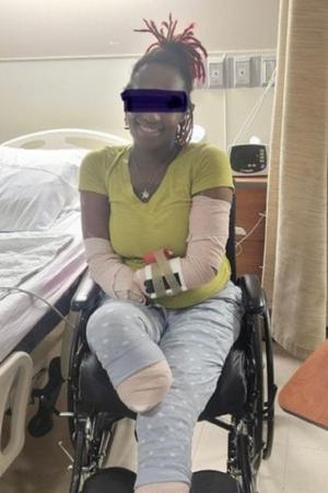 O mamă a trei copii şi-a pierdut mâinile şi picioarele în urma unor complicaţii provocate de Covid-19, în SUA: "Aceasta este realitatea"