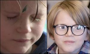 Un tată i-a lipit din greşeală ochii fiului său de 9 ani, după ce a încurcat picăturile medicale cu tubul de super-glue, în UK