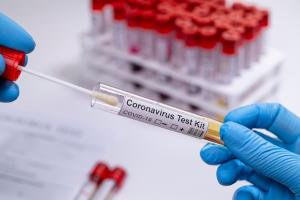Bilanț coronavirus în România, 2 februarie. 111 persoane decedate în ultimele 24 de ore