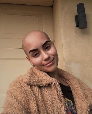 O adolescentă de 18 ani care a crezut că a învins cancerul de două ori, a murit din cauza cumplitei boli, în Australia: „Masam o tumoare și nu mi-am dat seama niciodată”
