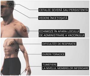 Care sunt simptomele care anunță un episod trombotic, după vaccinarea cu AstraZeneca. Explicațiile lui Valeriu Gheorghiță