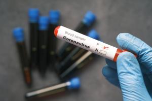 Bilanț coronavirus în România, 14 mai. 835 de cazuri noi şi 105 decese, în ultimele 24 de ore