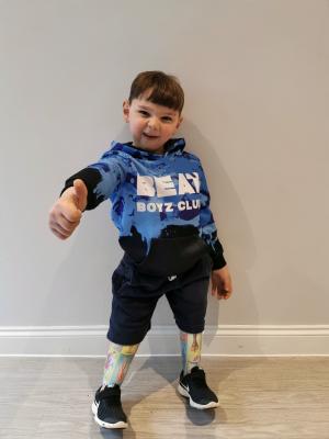 Un băiețel de 6 ani cu picioarele amputate, maltratat de părinţi, a reușit să meargă din nou, în Marea Britanie