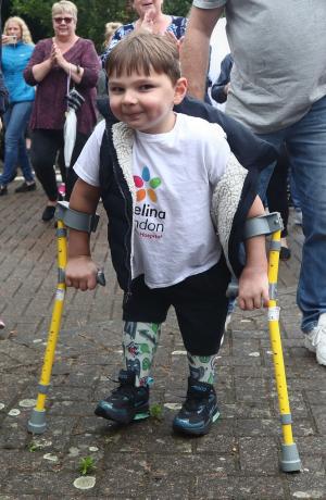 Un băiețel de 6 ani cu picioarele amputate, maltratat de părinţi, a reușit să meargă din nou, în Marea Britanie