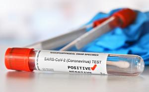 Bilanț coronavirus în România, 10 septembrie. Peste 2.500 de cazuri noi și 41 de decese, în ultimele 24 de ore