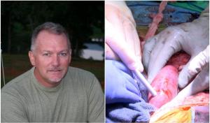 Premieră medicală în SUA. Rinichii unui porc, transplantaţi cu succes în corpul unui pacient aflat în moarte cerebrală