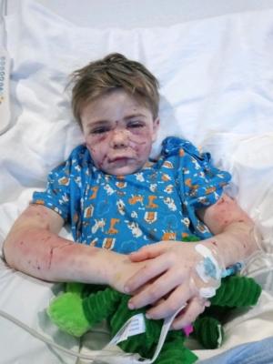 "L-a târât în şanţ. A fost oribil!". Copil de 7 ani, desfigurat de câinele unui vecin. Băiatul din Texas a fost salvat în ultima clipă de o vecină