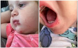 Coșmarul prin care a trecut o fetiță de doi ani după ce a fost pupată pe gură de un adult. ”Învață din experiența mea!”