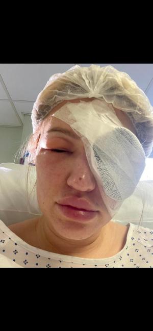 O tânără care a mers la medic în UK pentru dureri de cap constante a aflat că suferă de o tumoră. Este o "bombă cu ceas"