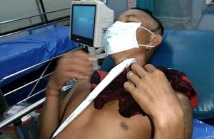 Turist ghinionist, în stare gravă la spital, după ce un peşte zargan l-a înţepat în gât, în timp ce înota, în Thailanda