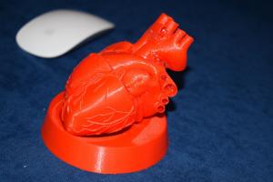 Cum arată inima 3D realizată după imaginile obţinute prin CT de la un pacient. A fost printată în premieră naţională în Mureş