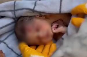 Imaginea unei dureri dincolo de cuvinte: Bebeluș scos de sub dărâmături după 60 de ore, ținând strâns în pumnișorul lui o șuviță din părul mamei