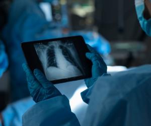 A trăit fără plămâni 48 de ore, până la transplant. Cum l-au ținut medicii în viață