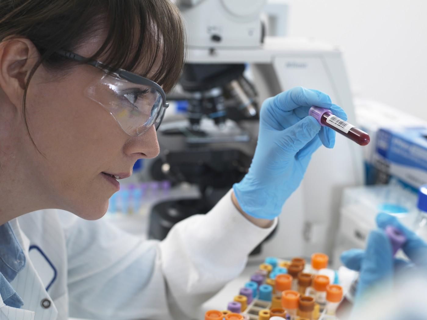 Demenţa ar putea fi diagnosticată cu până la 25 de ani înainte de apariţia simptomelor de un test de sânge