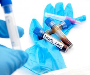 A fost confirmat primul caz de hantavirus în România, la un pacient din Arad. Reacţia INSP